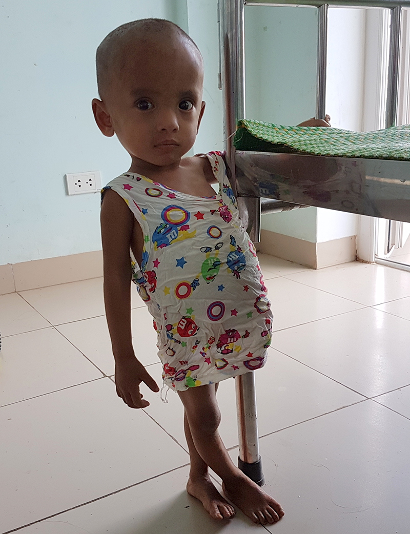 Đã 3 tuổi nhưng Thi chỉ nặng 6,3 kg